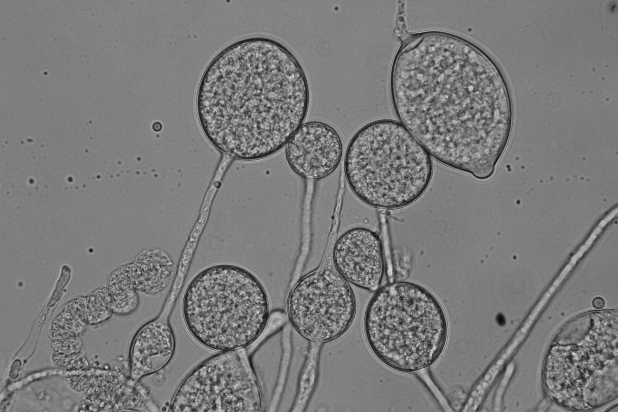 Phytophthora nicotianae – nebezpečný polyfágní patogen v České republice.